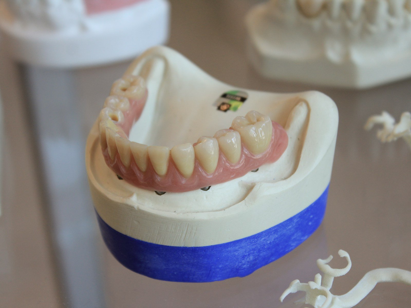 Dentures at Glenrothes Dental House