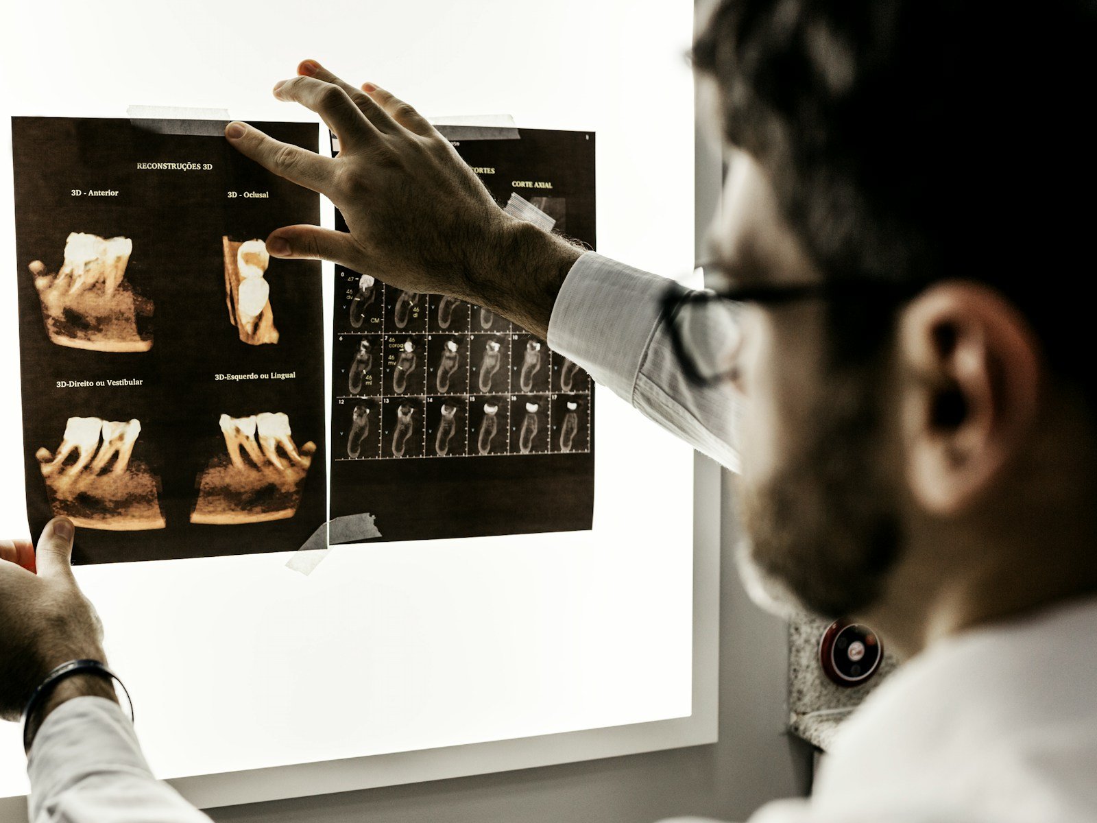 Root canal x-ray review at Glenrothes Dental House