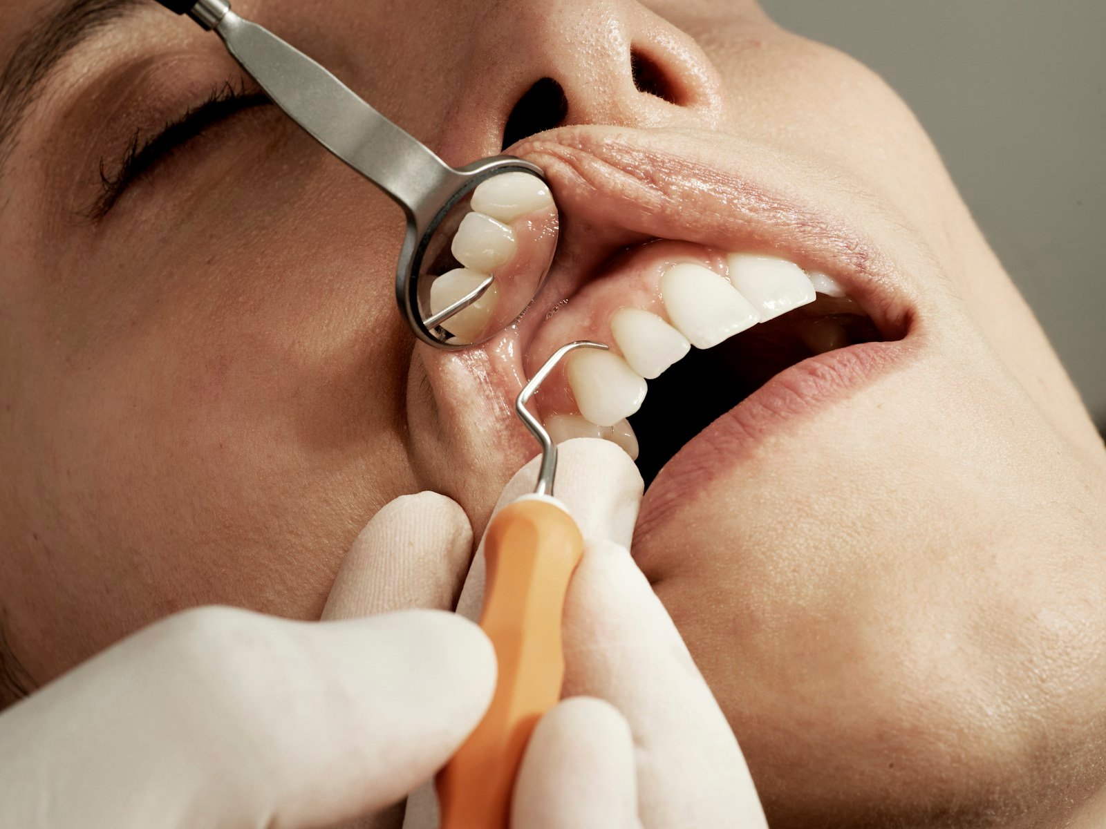 General dentistry examination at Glenrothes Dental House