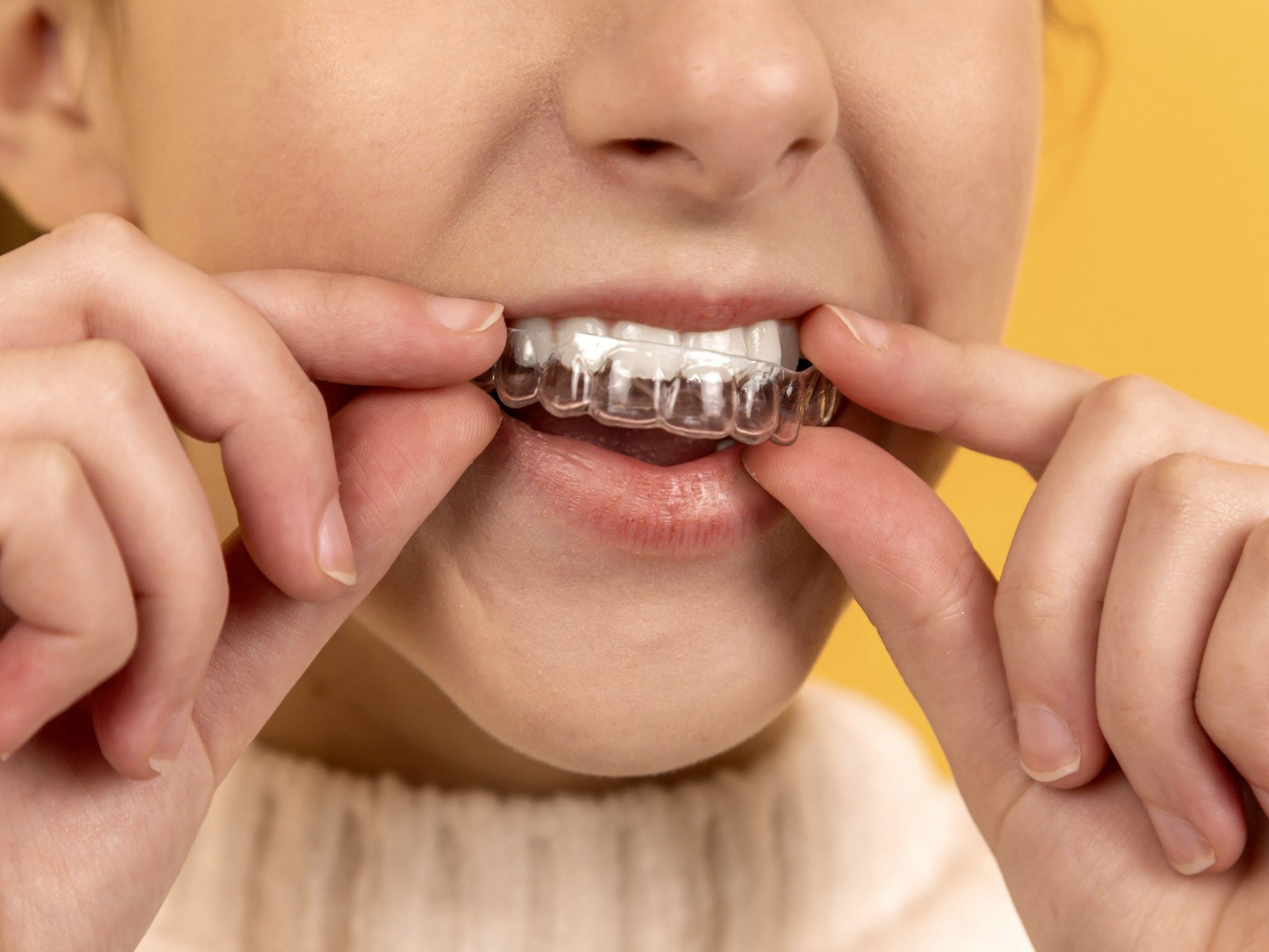 Clear aligner teeth straightening at Glenrothes Dental House