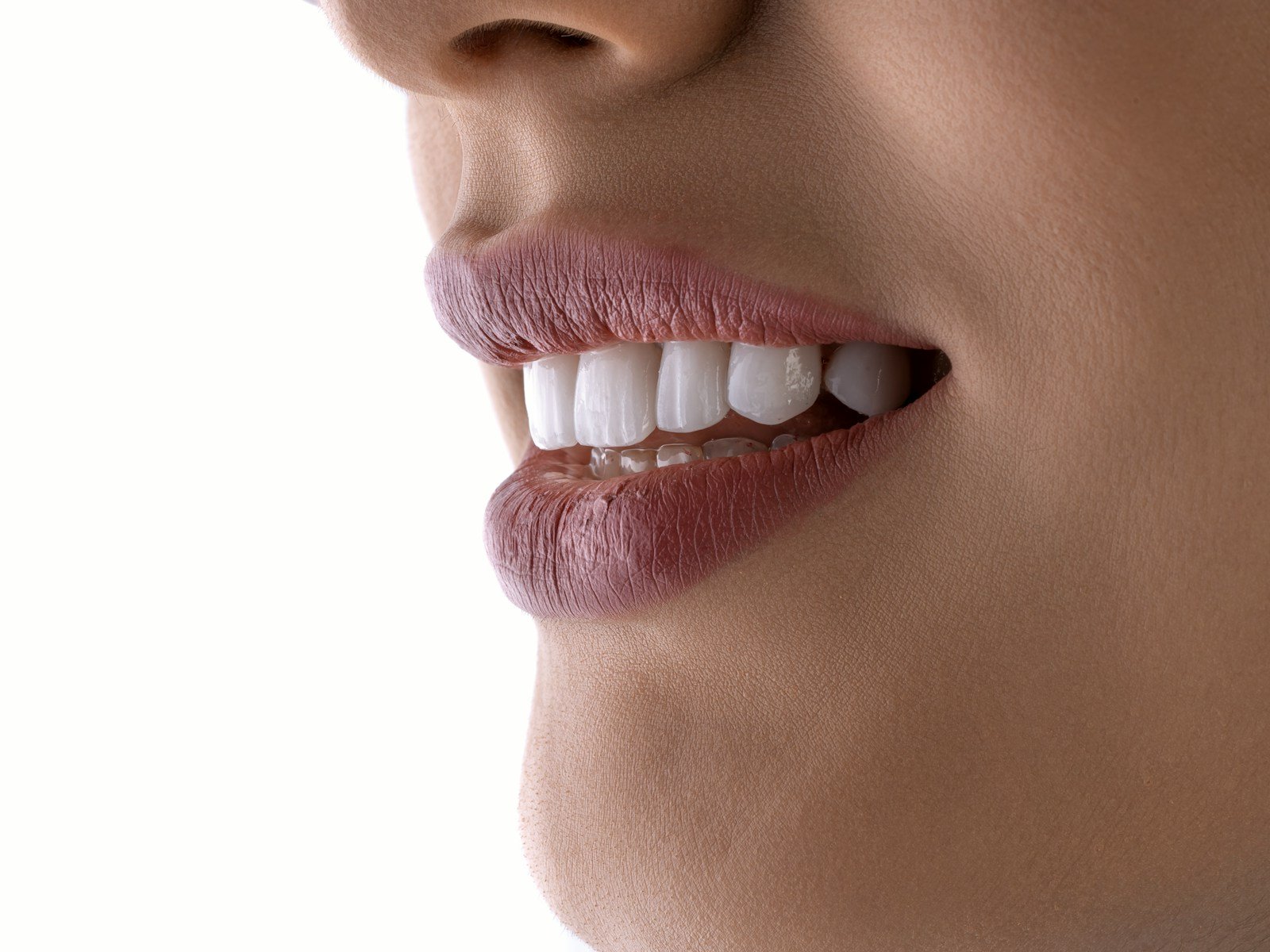 Porcelain veneers smile at Glenrothes Dental House